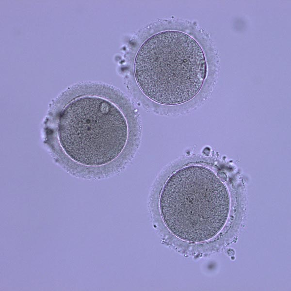 embrio-fiv-ambato-reproduccion-humana-asistida-quienes-somos2