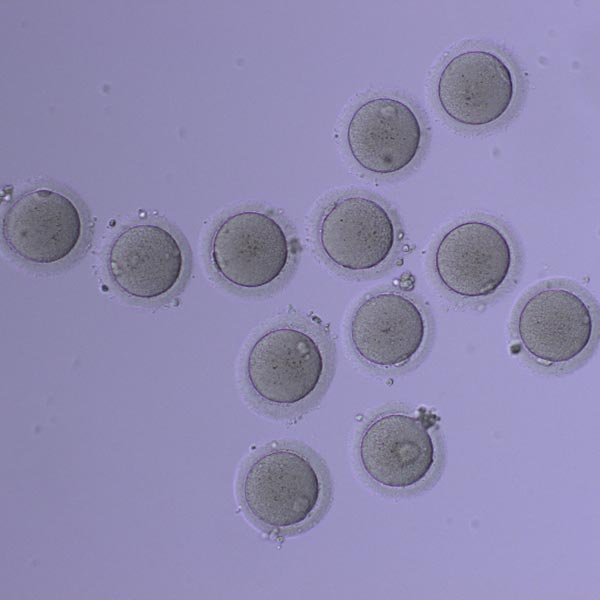 embrio-fiv-ambato-reproduccion-humana-asistida-quienes-somos6